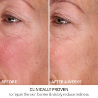 دكتور دينيس جروس سيروم اصلاح البشرة 7 مل ميني