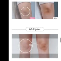 كريم تفتيح وتبيض البشرة وايتنينغ دريس - 50مل