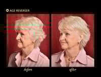 مشبك شد الوجه الخفي ايدج ريفيرزر شريط لشد العينين...