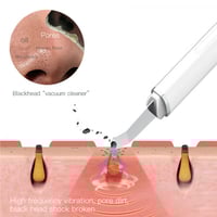 جو جو جهاز تنظيف الوجه والرؤس السوداء