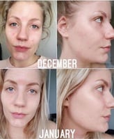 ذا اوردينري محلول نياسيناميد 10٪ زنك 1٪ - 30 مل