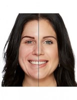 توفيسد كونسيلر ناتشرول بيج 13.5 مل