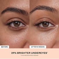 كريم العيون + ينور منطقة العين