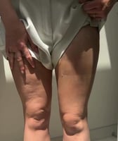 لصقات لأخفاء السلوليت/ 30 قطعه