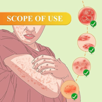 كريم سم النحل للصدفية