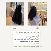 مٌعالج JH البرازيلي