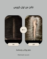 ZERO.10 عبوتين حجم العبوة الواحدة ٥٠ مل