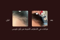 ZERO.10 عبوتين حجم العبوة الواحدة ٥٠ مل