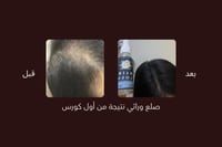 ZERO.10 عبوتين حجم العبوة الواحدة ٥٠ مل