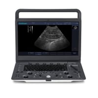 جهاز E1V من SonoScape