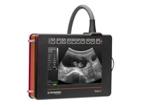 جهاز iScan2 من DRAMIŃSKI