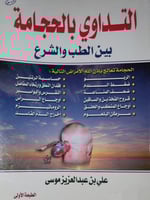 التداوي بالحجامة