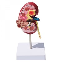 نموذج تشريحي للكلية - Anatomical model of the kidn...