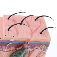 نموذج تشريحي ثلاثي الأبعاد تخطيط توسيع الجلد البشر...