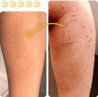 مجموعة سكراب بالموز 3 عبوات -لتقشير البشرة وإزالة...