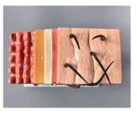 نموذج تشريحي ثلاثي الأبعاد تخطيط توسيع الجلد البشر...