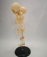 نموذج الهيكل العظمي لجنين مزدوج الرأس