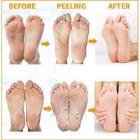 ام بيوتي جوارب سحرية لتقشير القدمين 40 ج