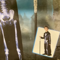 هيكل عظمي ولادي