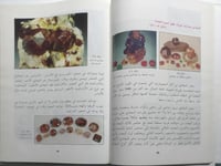 المعادن النفيسة والأحجار الكريمة وشبه الكريمة الطب...