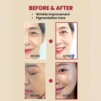 سيروم سيول 1988 بالريتينال والجينسنغ الأسود من كي...