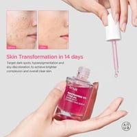 سيروم مصحح للبقع الداكنة 10% نياسيناميد 4% تي اكس...