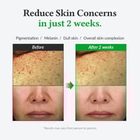 سيروم فيتامين سي اللطيف من دكتور الثيا - 30 مل