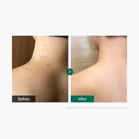 مجموعة المعجزة للعناية بالشعر والجسم من سوم باي مي...