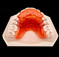 224. جهاز رفع عصة امامي Anteriror bite plan
