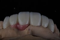 **127 . تاجِِ من الزيركام كامل إم إل ملون ZirCam Z...