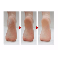 الجوارب السحرية لتقشير القدمين من ام بيوتي