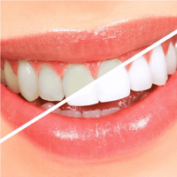 معجون أسنان ومبيض من لاكالوت - 75 مل