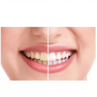 مناديل تنظيف الأسنان من ويلزياد - 12 منديل