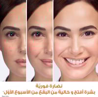 كريم إشراقة سريع للبشرة سكين اكتيف من غارنييه - 10...