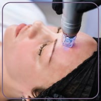 جلسة سكارليت لمعالجة ندبات حب الشباب (كامل الوجه)