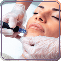 جلسة الديرما بن مع 1 مل ميزوثرابي (Derma Pen)