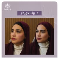 حقن الفيلر 1 مل