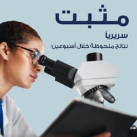 نيزورال كيتوكونازول شامبو 100 مل - Nizoral