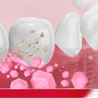 معجون أسنان بارودونتكس الترا كلين مضاد للبكتيريا ي...