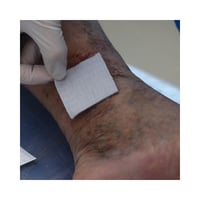 ضماد اكواسيل بالفضة 5سم×5سم