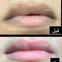 مقشر للنساء لتوريد شفايف وازاله التصبغات