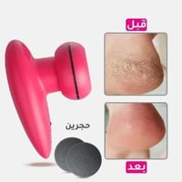 جهاز كينو لإزالة تشققات القدمين - روزانا