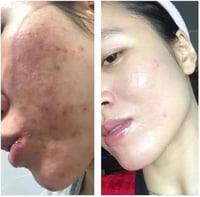 كريم سكينورين 30 جرام