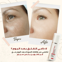 سيروم فيلاكوين بلس لتفتيح وتوحيد لون البشرة وعلاج...