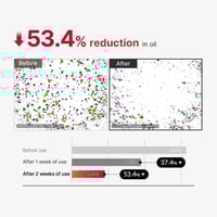 بخاخ تقشير الجسم لعلاج حب الشباب من ميديكيوب - 110...