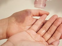 تونر منظف المسام بخلاصة السنتيلا من سكين1004 - 210...