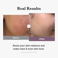 تونر جلوتاثيون للتفتيح والتوهج ايج أر من ميديكيوب...