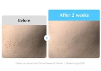 سيروم مرطب ومهدئ و منعش للبشرة من ايكوال بيري - 50...