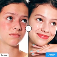 سيروم هيالوتوين للترطيب المكثف من ايكوال بيري - 30...