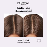 شامبو ايلفيف هيالورون بيور منقي للشعر الدهني من لو...